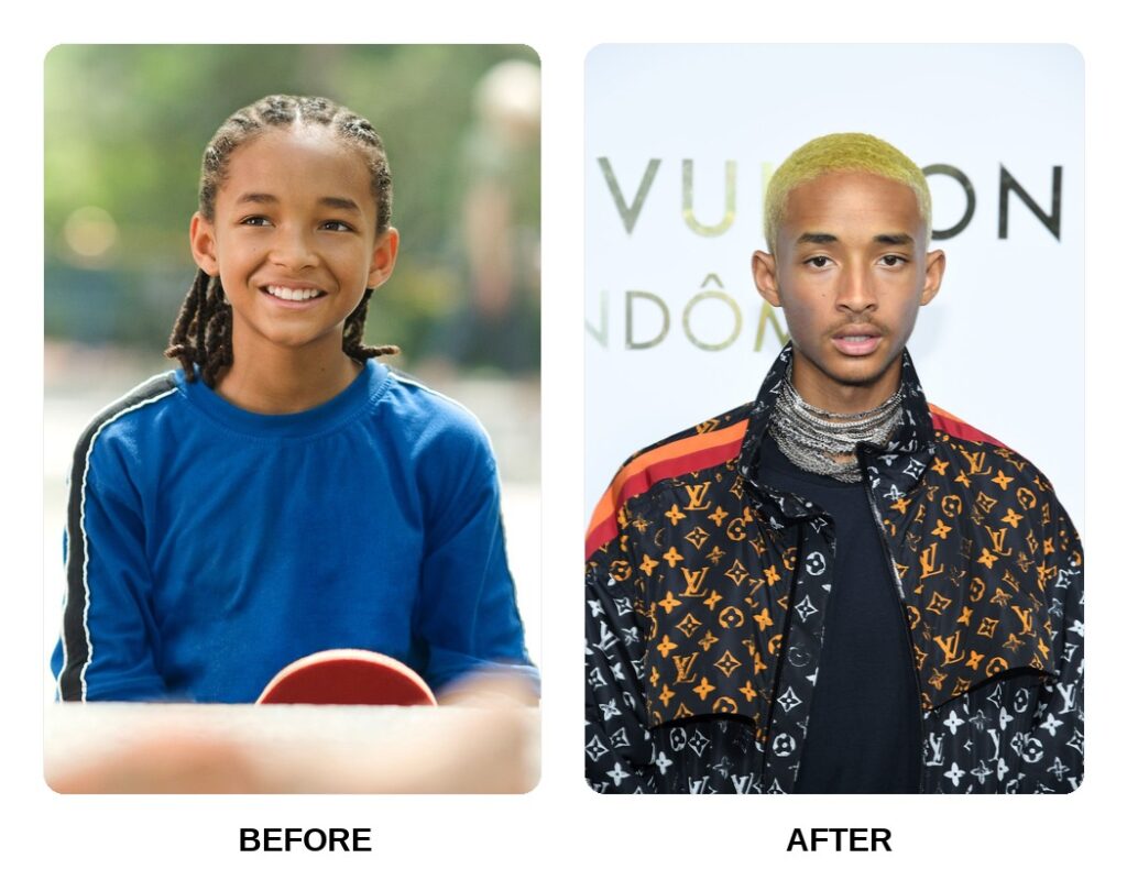 Jaden Smith Teeth Before and After: What Happened in His Transformation?