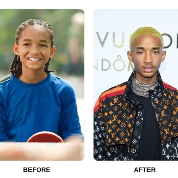 Jaden Smith Teeth Before and After: What Happened in His Transformation?