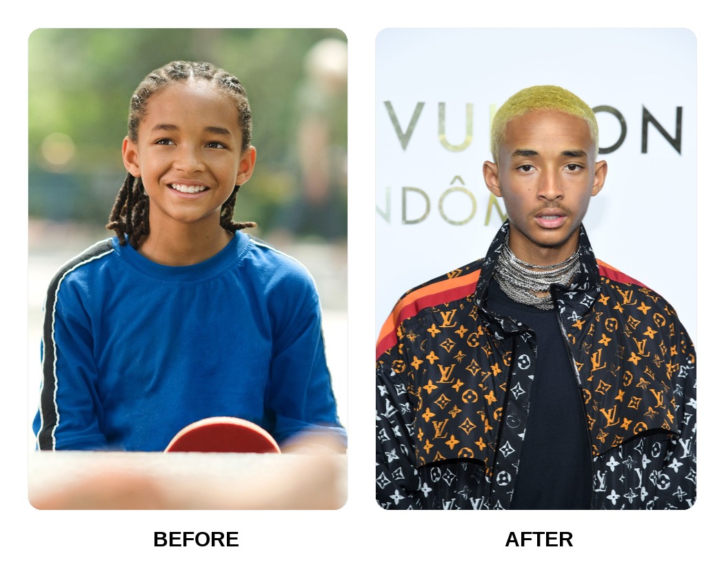 Jaden Smith Teeth Before and After: What Happened in His Transformation?