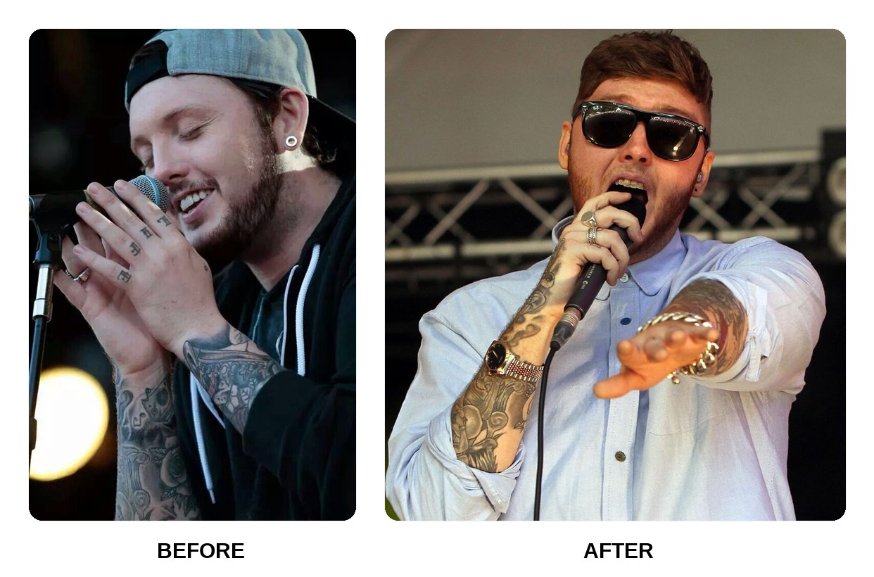 James Arthur teeth in his youth