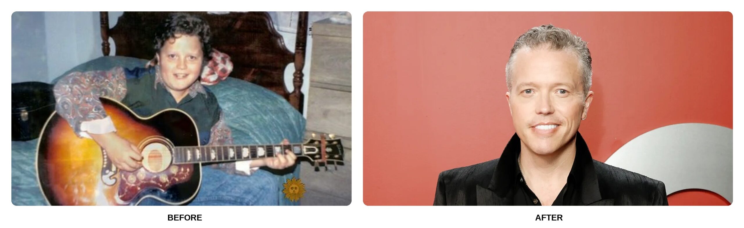 Jason Isbell Teeth Before and After: What Happened in His Transformation?