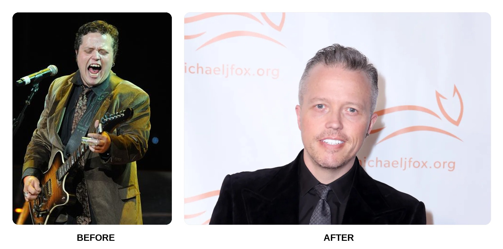 Jason Isbell teeth in his youth