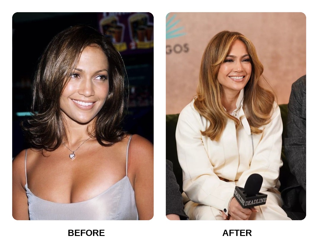 Jennifer Lopez teeth in her youth