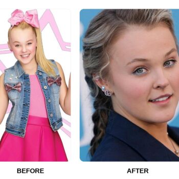 Jojo Siwa Teeth Before and After: What Happened in Her Transformation?