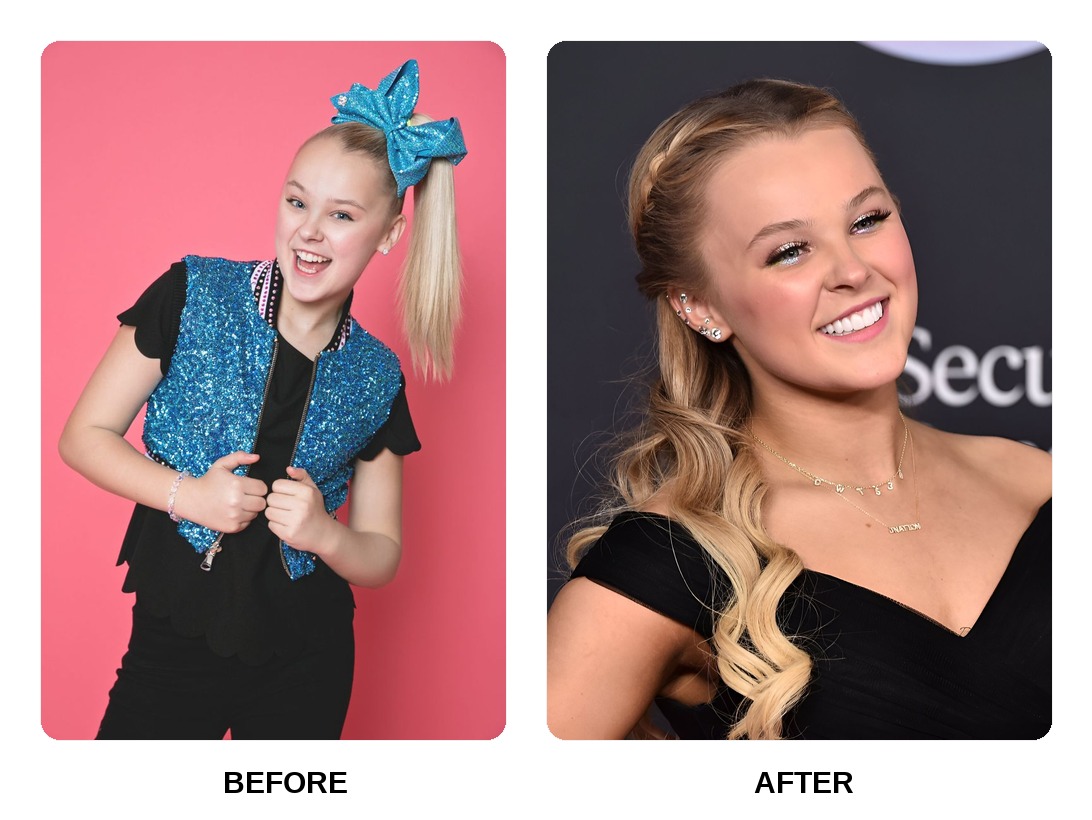 Jojo Siwa teeth in her youth