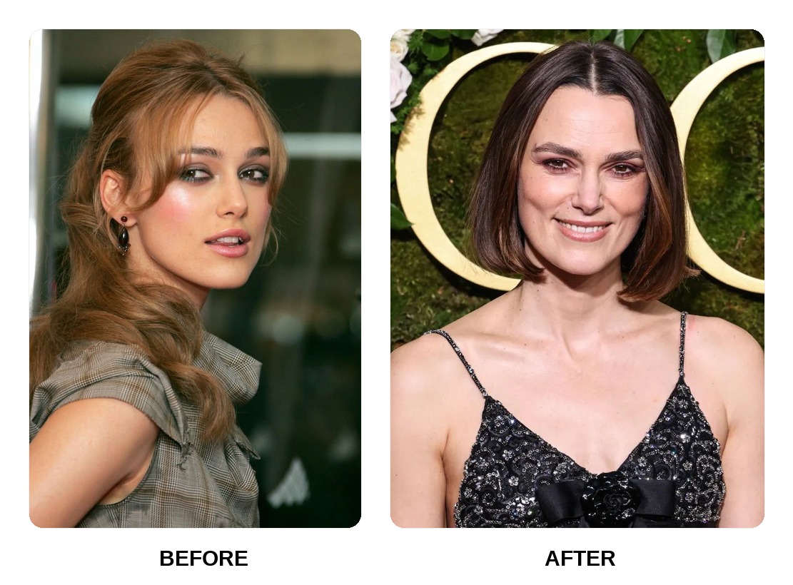 Keira Knightley teeth in his youth