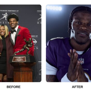 Lamar Jackson Teeth Before and After: What Happened in His Transformation?