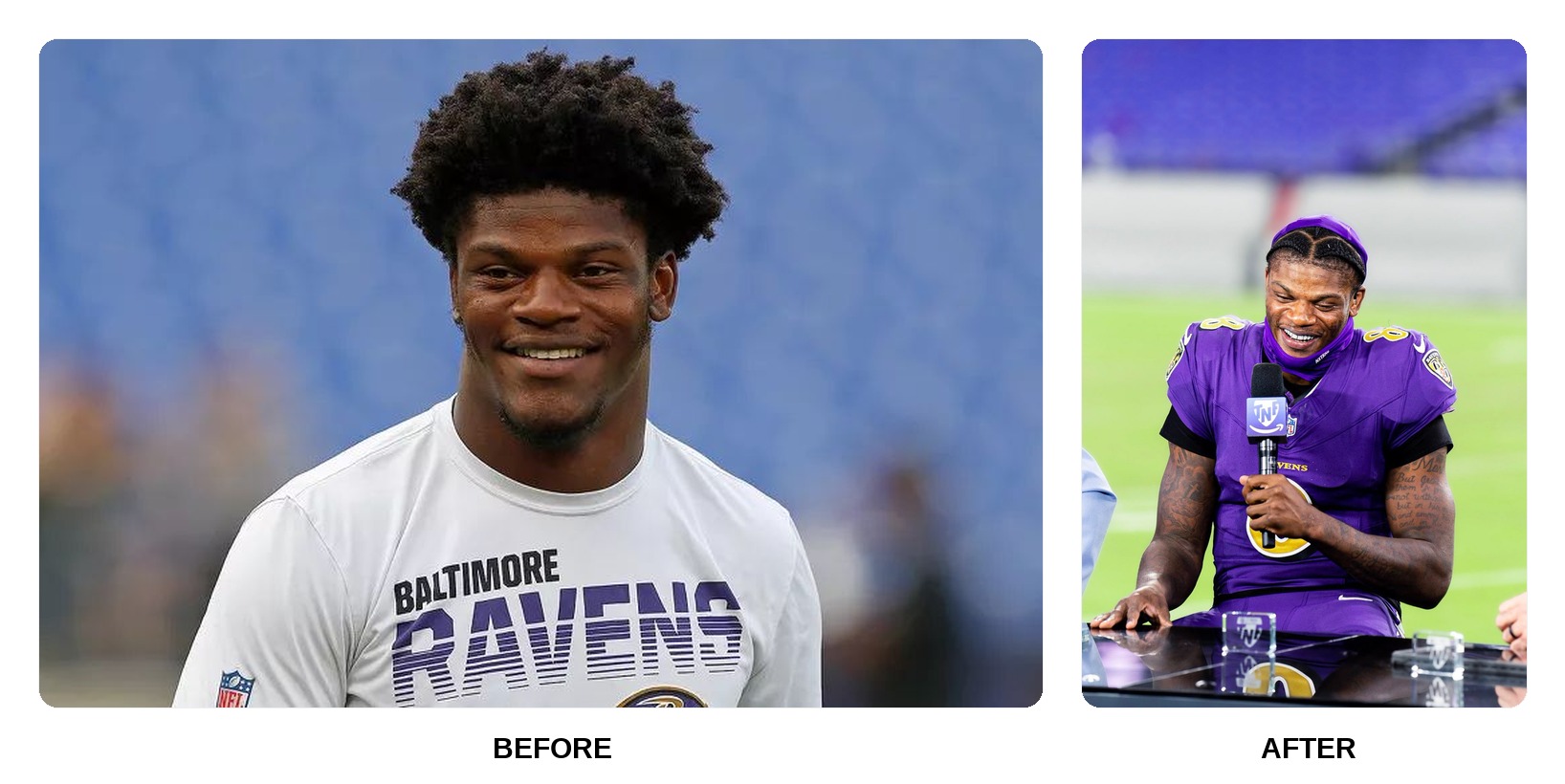 Lamar Jackson teeth in his youth