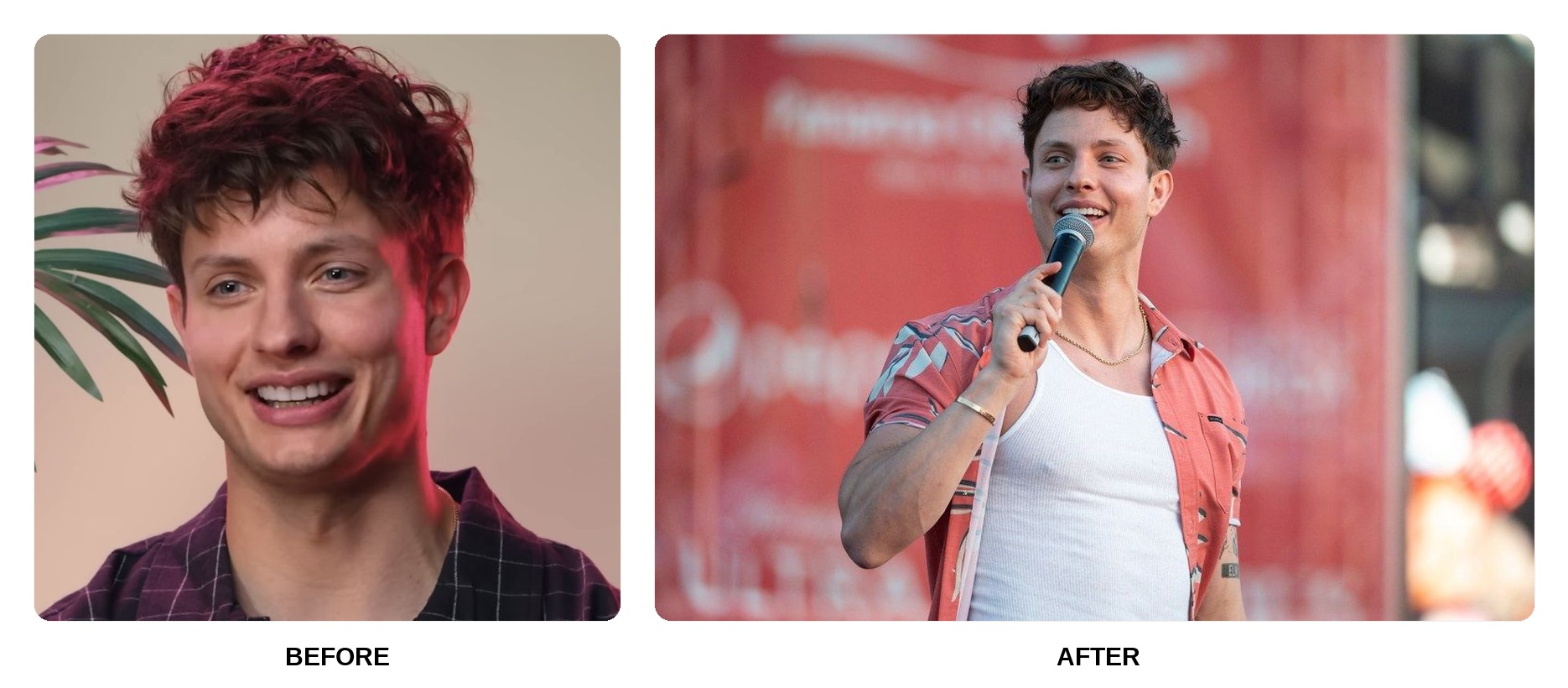 Matt Rife Teeth Before and After: What Happened in His Transformation?