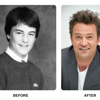 Matthew Perry Teeth Before and After: What Happened in His Transformation?