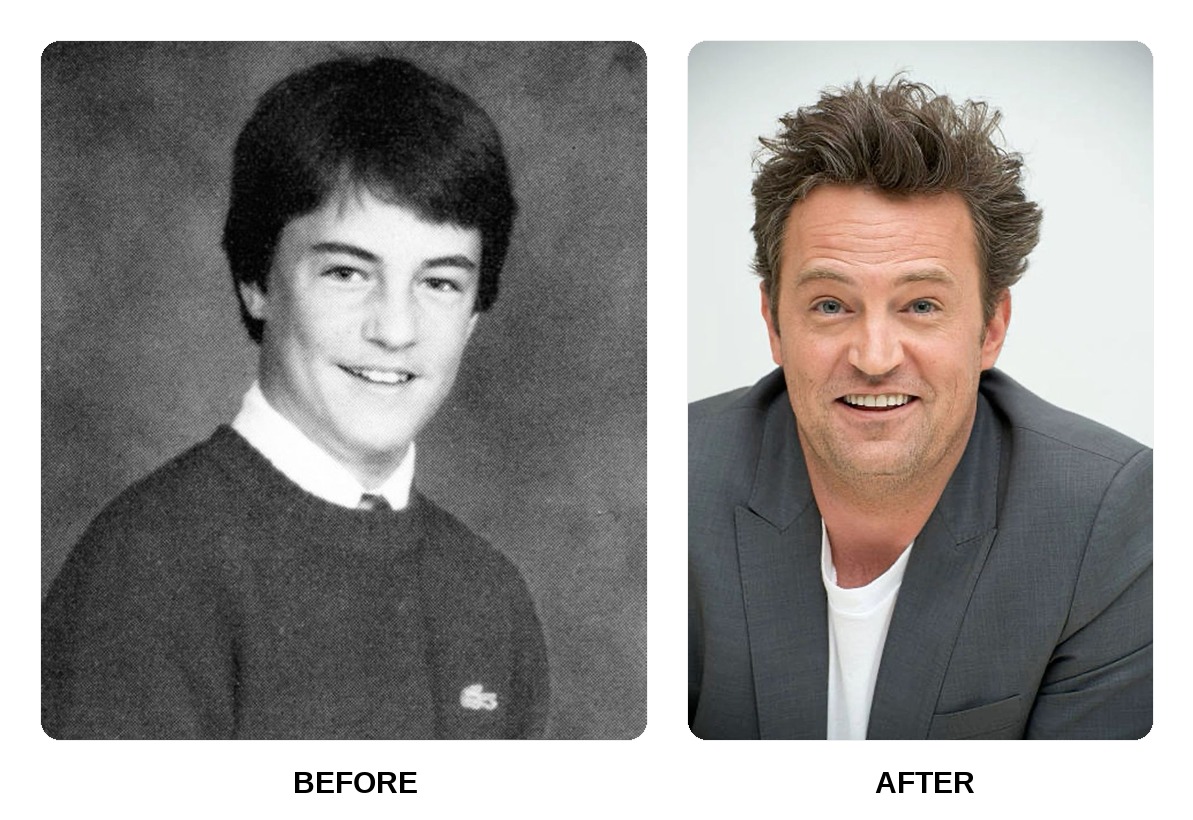 Matthew Perry Teeth Before and After: What Happened in His Transformation?