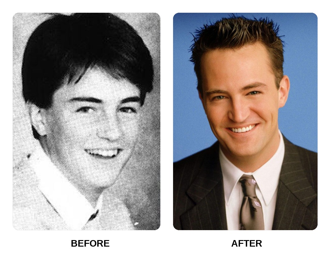 Matthew Perry teeth in his youth