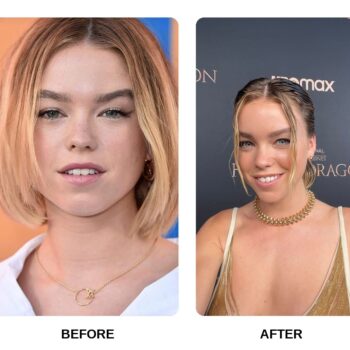 Milly Alcock Teeth Before and After: What Happened in His Transformation?