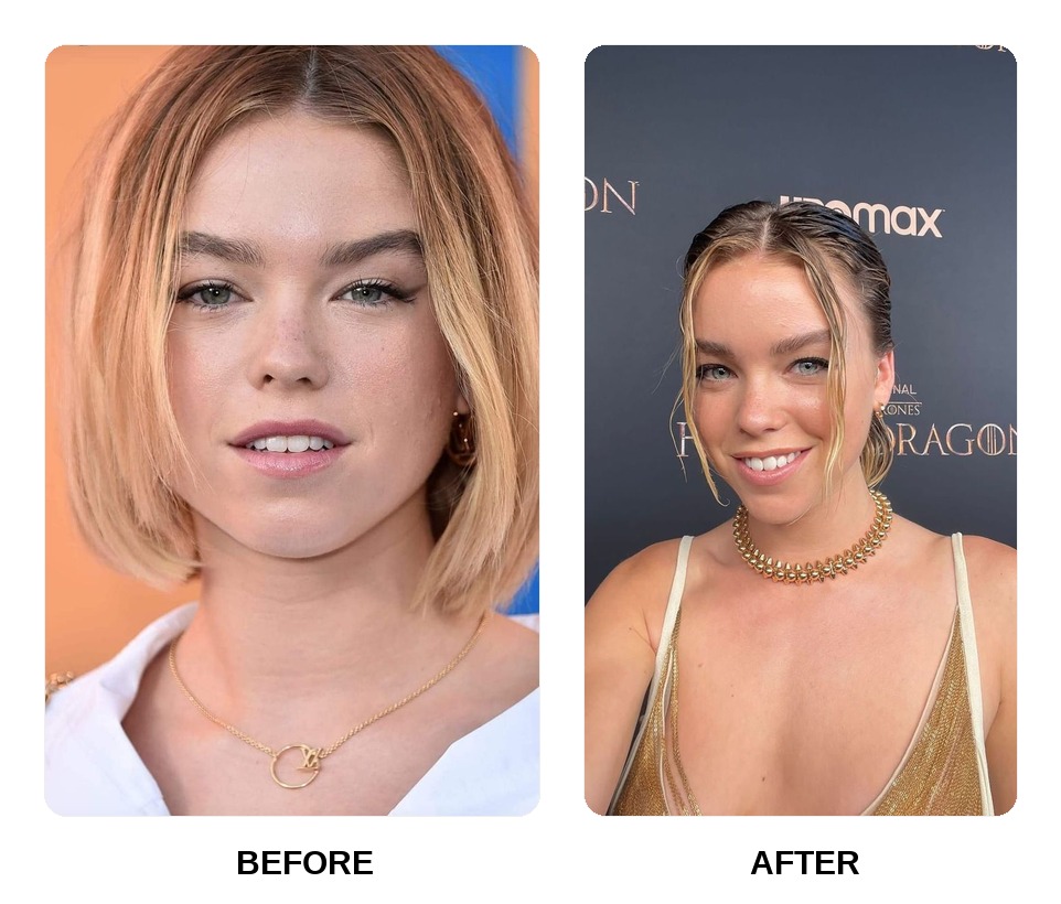 Milly Alcock Teeth Before and After: What Happened in His Transformation?