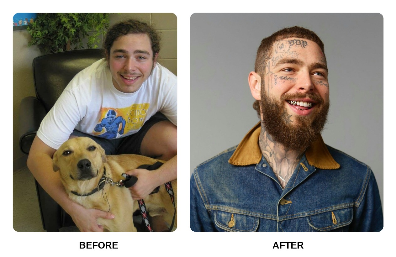 Post Malone teeth in his youth