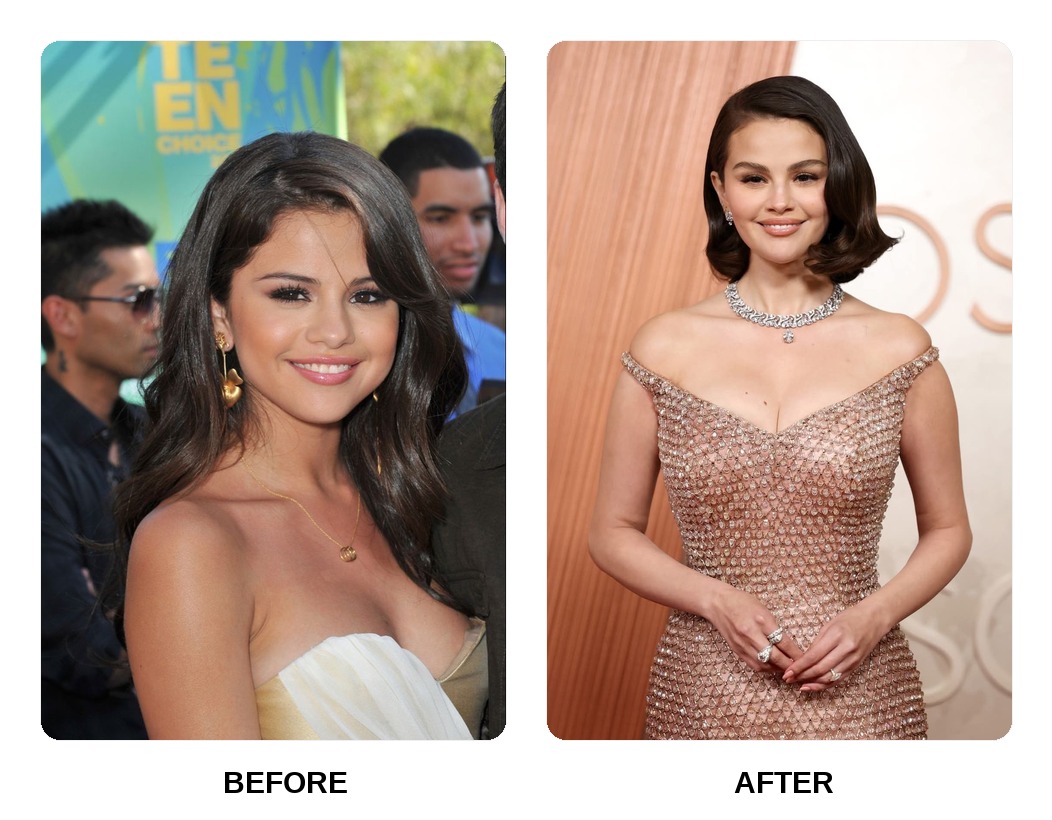 Selena Gomez teeth in his youth