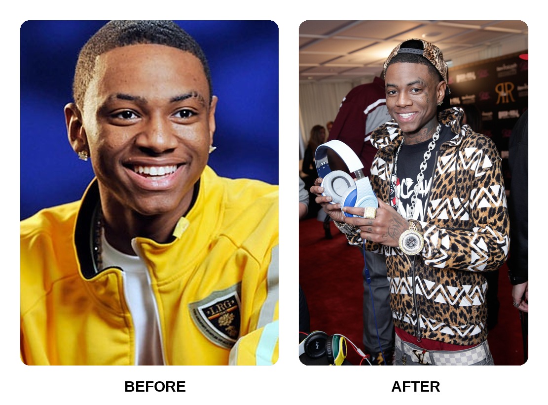 Soulja Boy Teeth Before and After: What Happened in His Transformation?
