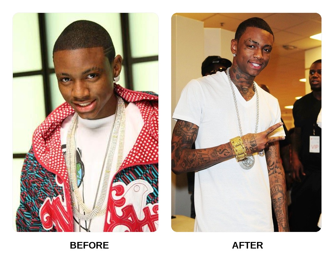 Soulja Boy teeth in his youth