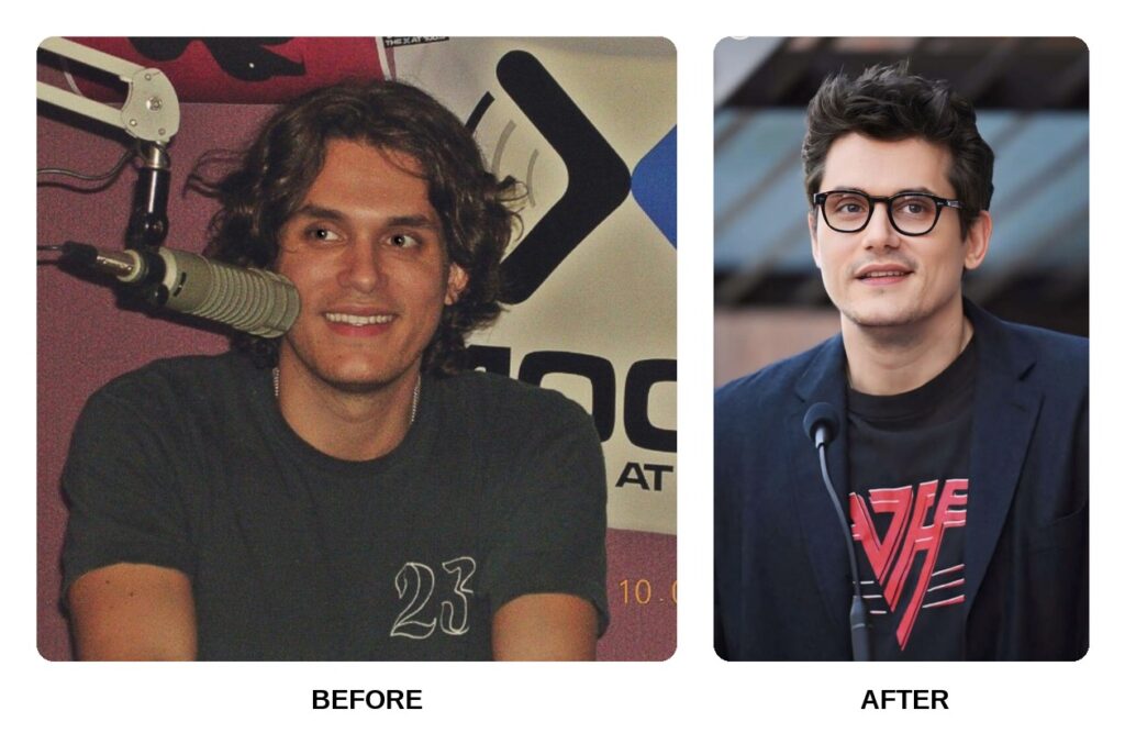John Mayer Teeth Before and After: What Happened in His Transformation?
