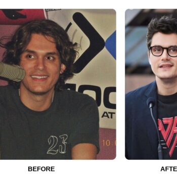 John Mayer Teeth Before and After: What Happened in His Transformation?