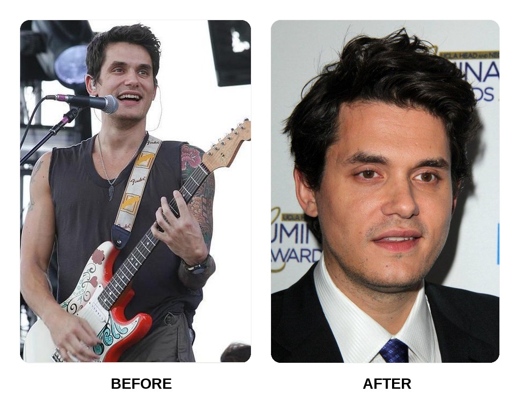 John Mayer teeth in his youth