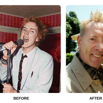 Johnny Rotten’s Teeth Before and After: What Happened in His Transformation?