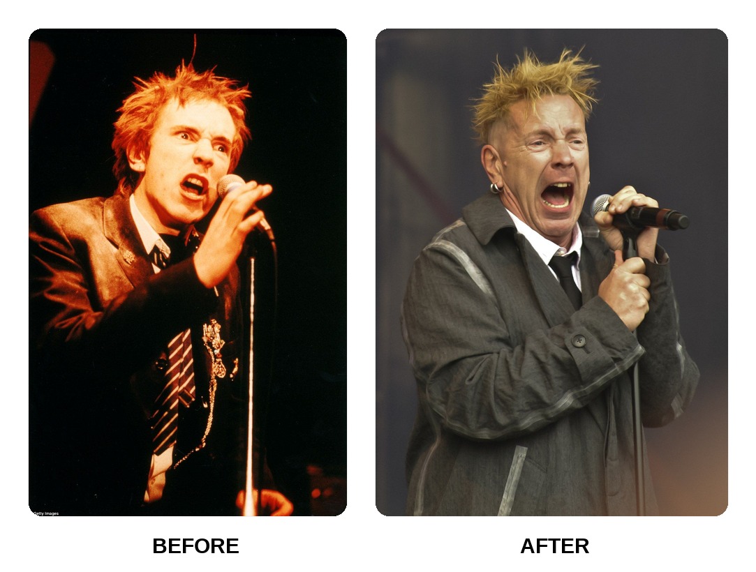 Johnny Rotten’s teeth in his youth