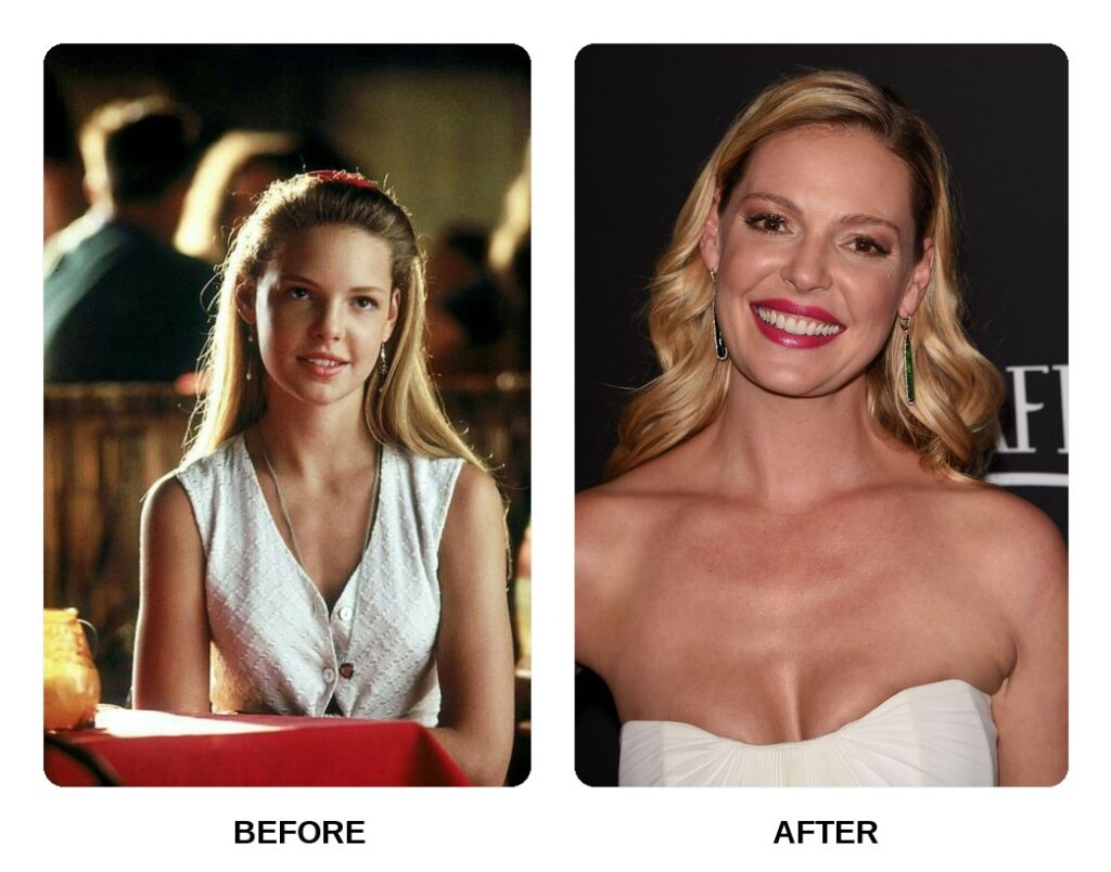 Katherine Heigl Teeth Before and After: What Happened in Her Transformation?