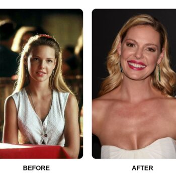 Katherine Heigl Teeth Before and After: What Happened in Her Transformation?