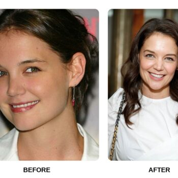 Katie Holmes Teeth Before and After: What Happened in Her Transformation?