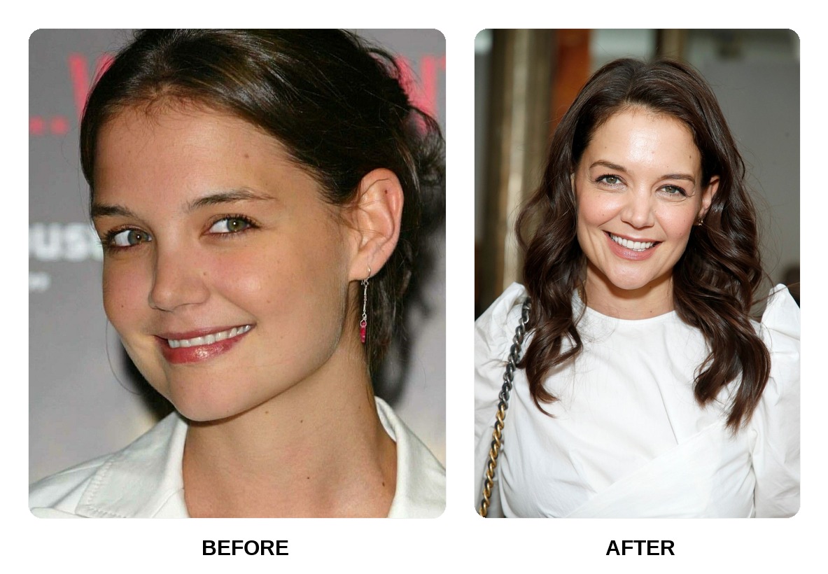 Katie Holmes Teeth Before and After: What Happened in Her Transformation?