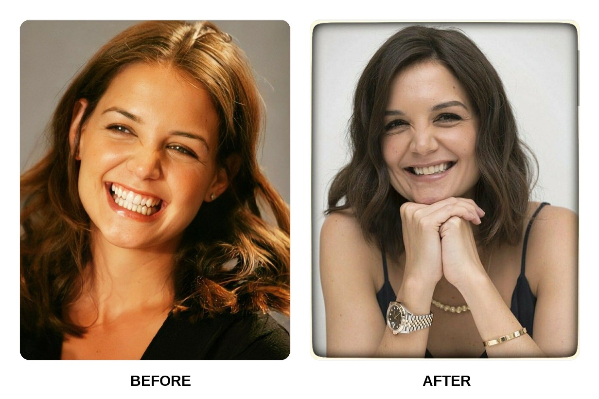 Katie Holmes teeth in her youth