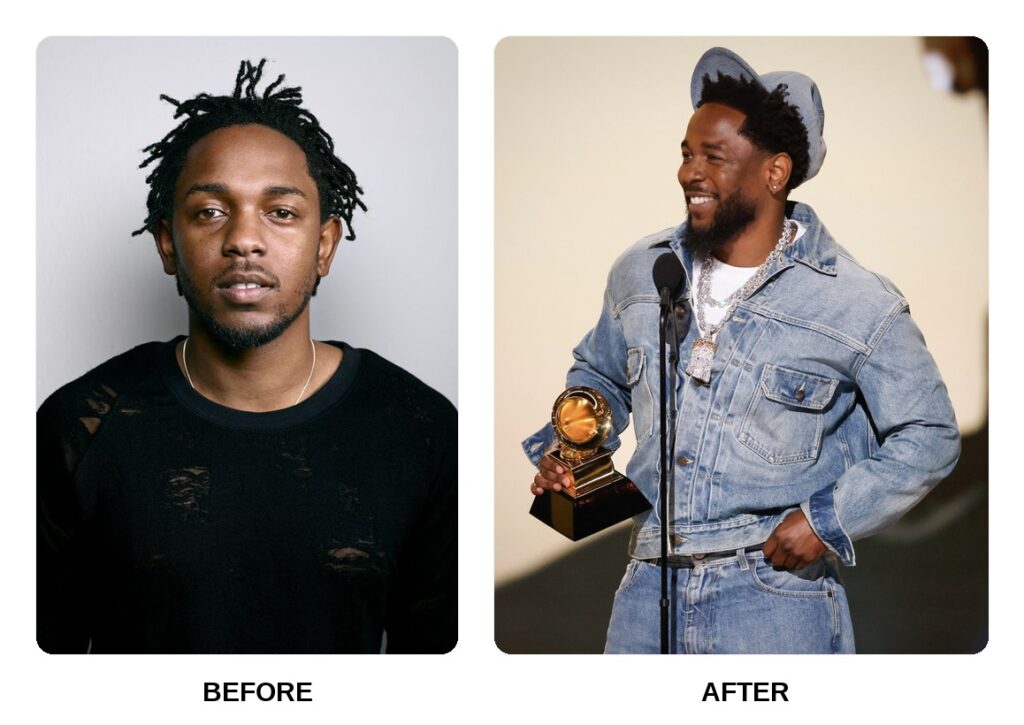 Kendrick Lamar Teeth Before and After: What Happened in His Transformation?