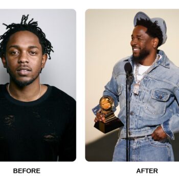 Kendrick Lamar Teeth Before and After: What Happened in His Transformation?