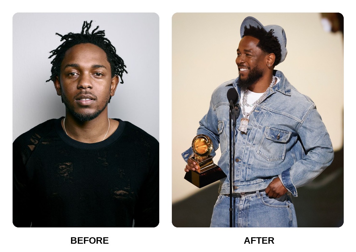 Kendrick Lamar Teeth Before and After: What Happened in His Transformation?
