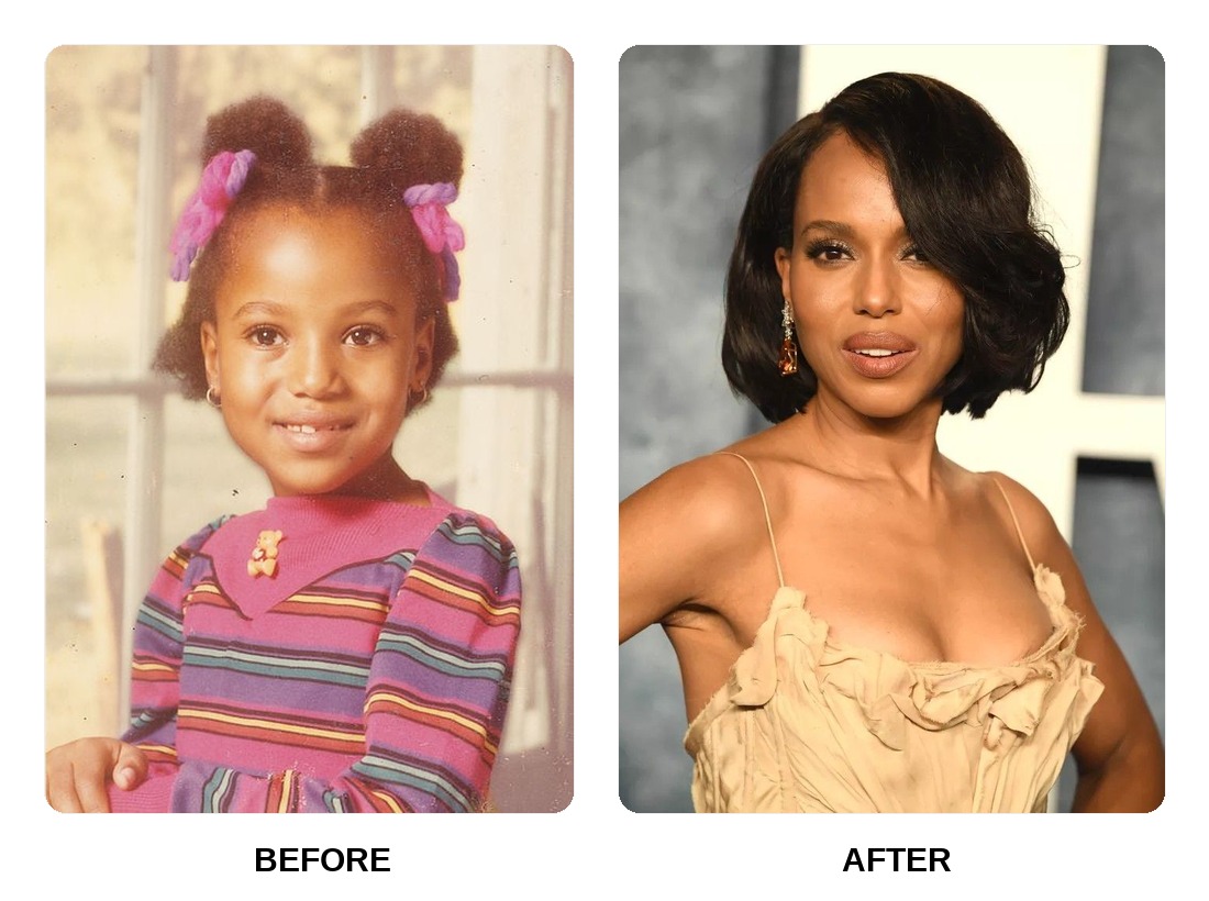 Kerry Washington Teeth Before and After: What Happened in Her Transformation?