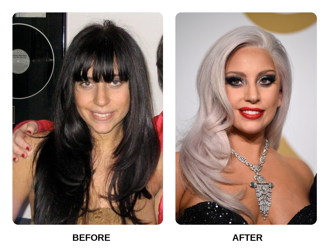 Lady Gaga teeth in her youth