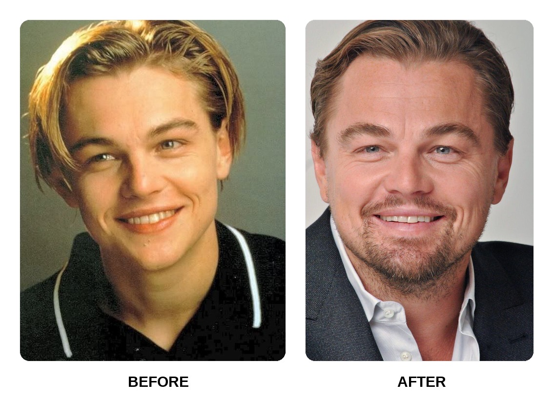 Leonardo DiCaprio teeth in his youth