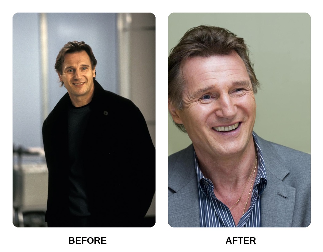 Liam Neeson Teeth Before and After: What Happened in His Transformation?