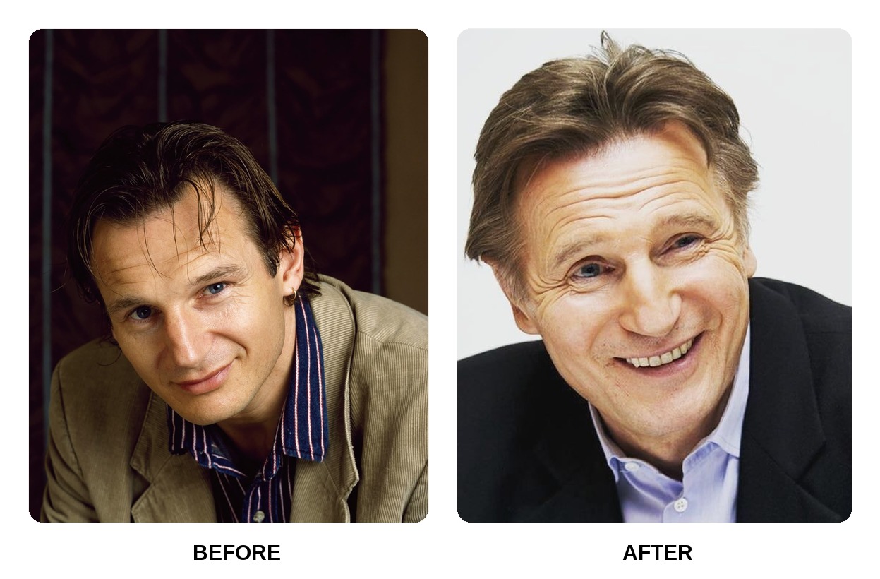 Liam Neeson teeth in his youth