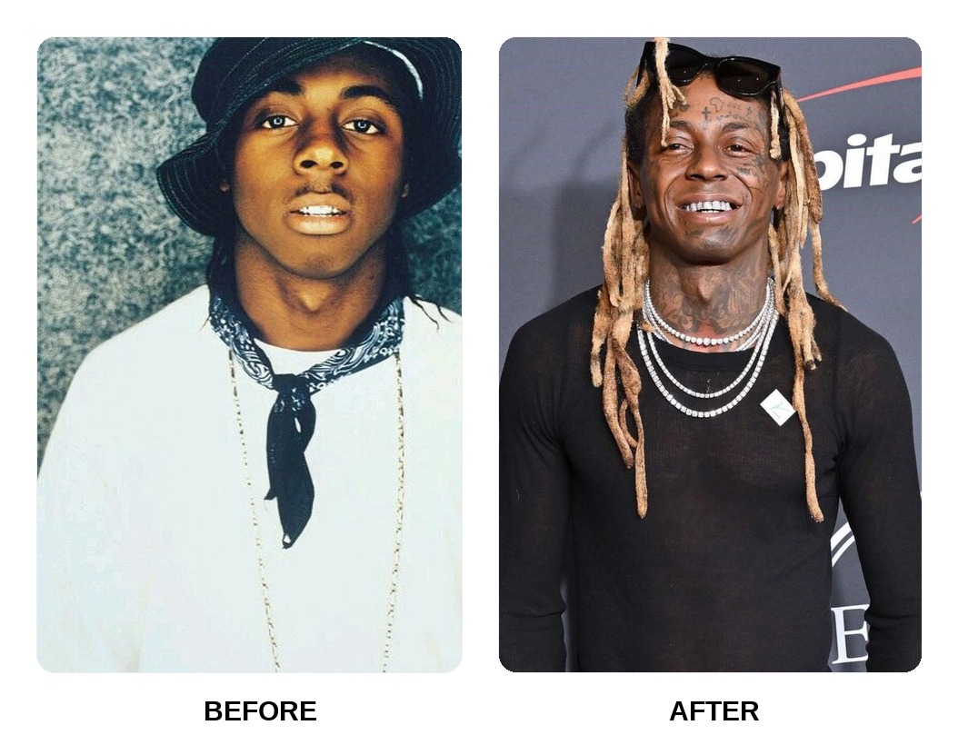 Lil Wayne Teeth Before and After: What Happened in His Transformation?