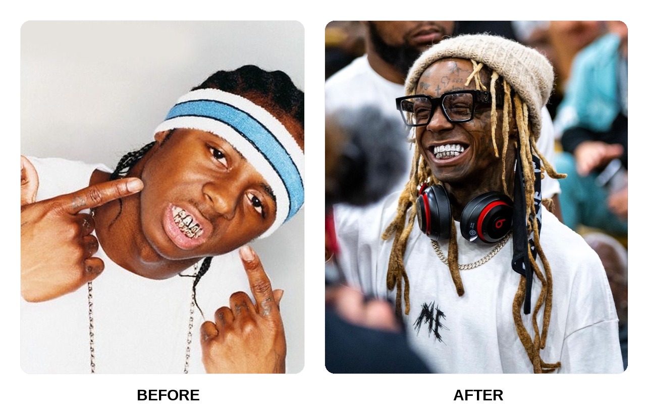 Lil Wayne teeth in his youth