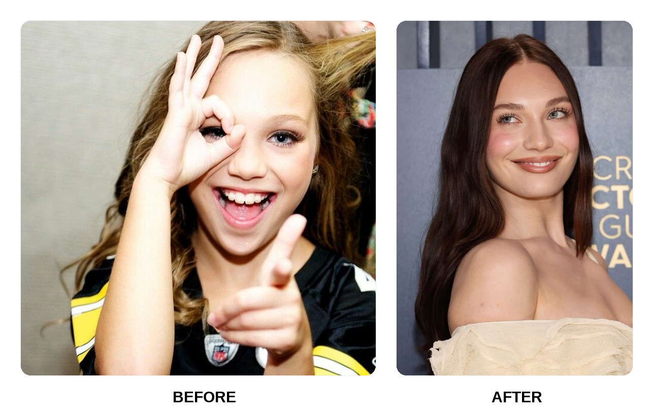Maddie Ziegler teeth in her youth