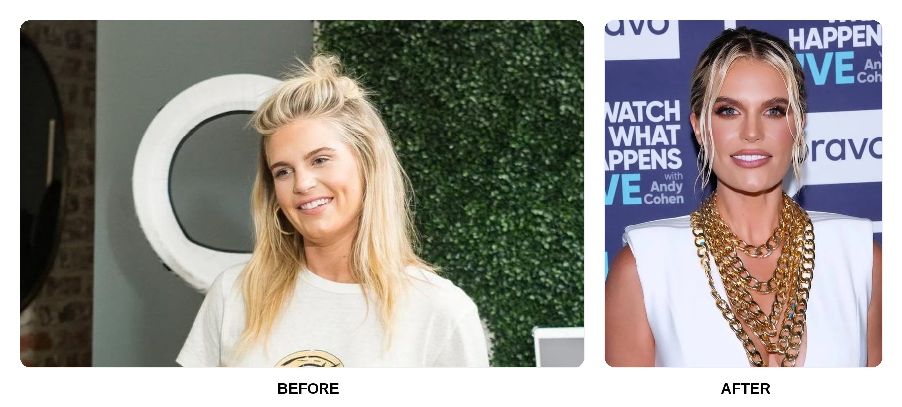 Madison LeCroy Teeth Before and After: What Happened in Her Transformation?