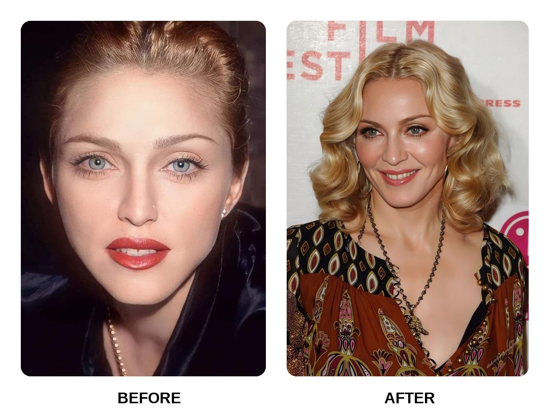 Madonna Teeth Before and After: What Happened in Her Transformation?