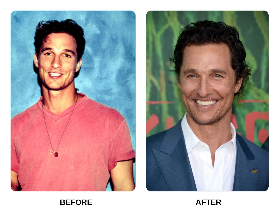 Matthew McConaughey Teeth Before and After: What Happened in His Transformation?