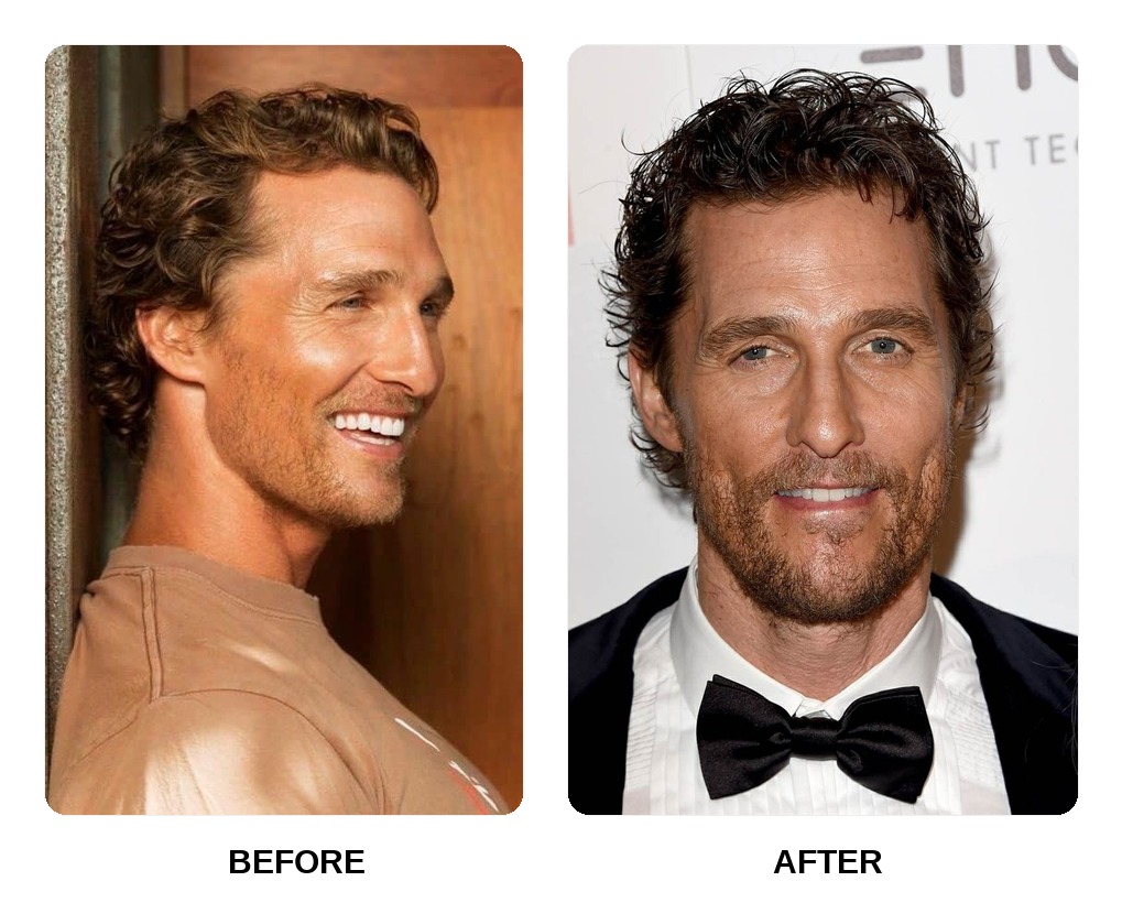 Matthew McConaughey teeth in his youth