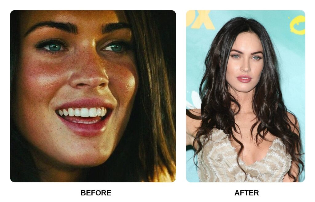 Megan Fox Teeth Before and After: What Happened in Her Transformation?