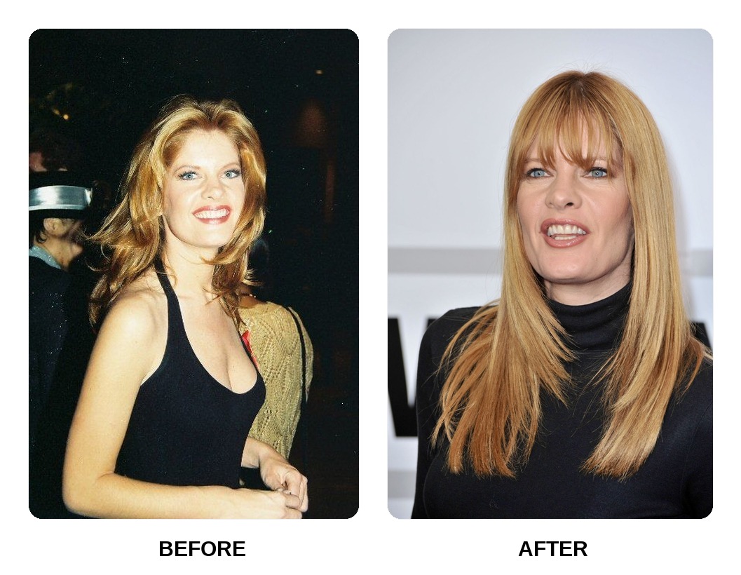 Michelle Stafford Teeth Before and After: What Happened in Her Transformation?