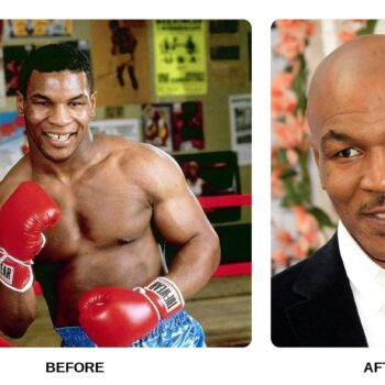Mike Tyson Teeth Before and After: What Happened in His Transformation?